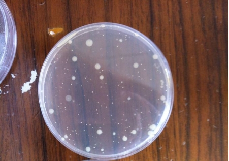 【行業(yè)干貨】從原理到實操:一文讀懂薄膜過濾法 vs 平皿法的適用邊界